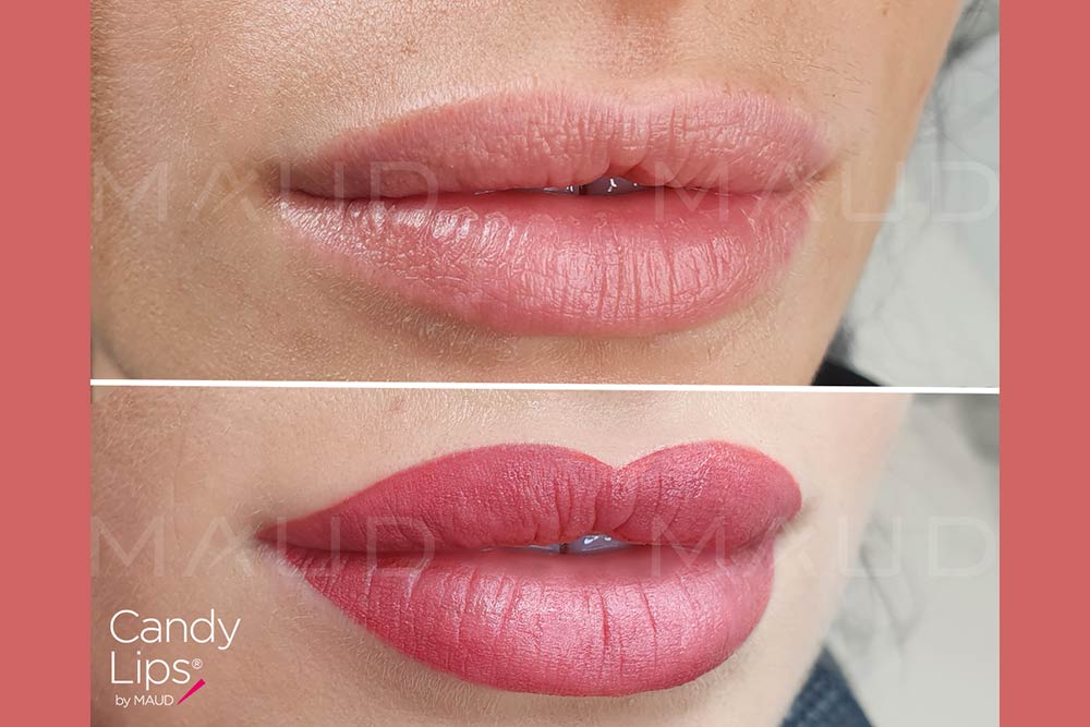 Des lèvres sensuelles et sublimes avec Candy Lips