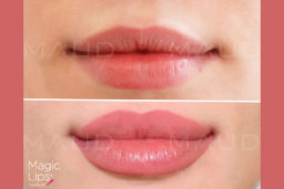 Des lèvres magnifiques avec le Magic Lips