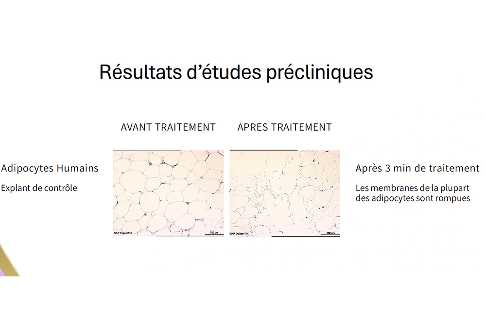 Des études qui démontrent l'efficacité de Slimiser.
