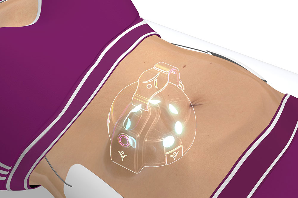 Slimiser - Des trains de micro-impulsions stimulent la musculature periartériolaire afin d'augmenter le drainage circulatoire et d’accélérer l’évacuation naturelle des graisses libérées.